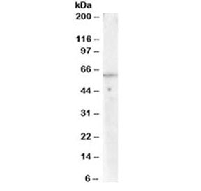 PPP2R1A Antibody