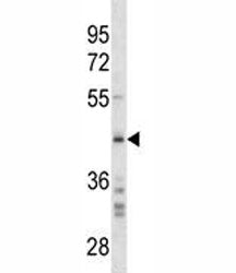 SPARC Antibody