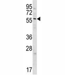 Glypican 3 Antibody (GPC3)