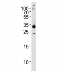 RPS6 Antibody