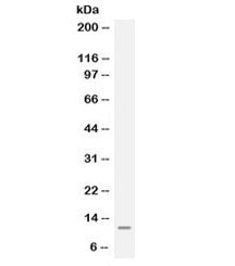 MGP Antibody / Matrix Gla protein