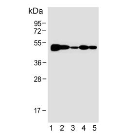 Bleomycin hydrolase Antibody / BLMH