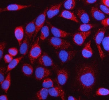 NTN3 Antibody / Netrin 3