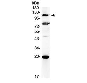 NFATC3 Antibody / NFAT4