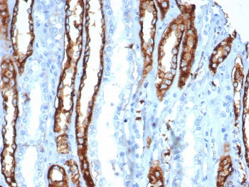 IHC staining of FFPE human kidney tissue with IL20RA antibody (clone IL20RA/0001). HIER: boil tissue