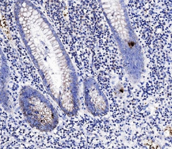 PYY Antibody / Peptide YY