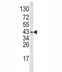 Western blot analysis of WNT5B antibody and mouse bladder tissue lysate. Predicted molecular weight