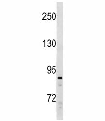 SUZ12 antibody western blot analysis in human Ramos cell lysate. Observed molecular weight 83~95 kDa