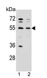NARS Antibody / AsnRS