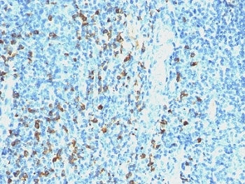 Lambda Light Chain Antibody / Lambda Antibody