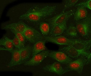 ALP Antibody / N-acetyltransferase-like protein / NAT10