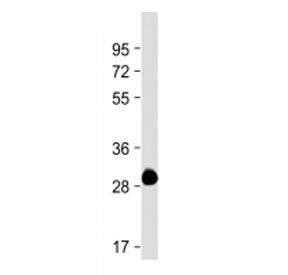 ROS1 Antibody