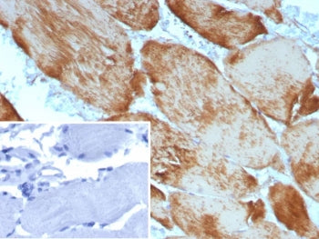 Alpha Actin Antibody / ACTA1 (skeletal muscle)