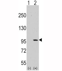 DDR1 Antibody