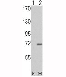 IRAK Antibody
