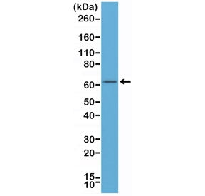Estrogen Receptor alpha Antibody / N-Terminal Region
