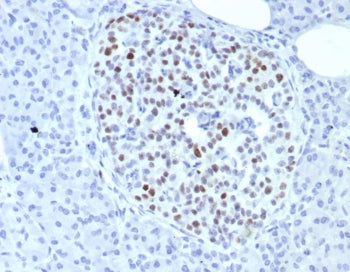 INSM1 Antibody / Insulinoma associated protein 1