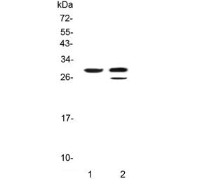 Western blot testing of 1) rat pancreas and 2) mouse pancreas with Kallikrein-1 antibody. Predicted
