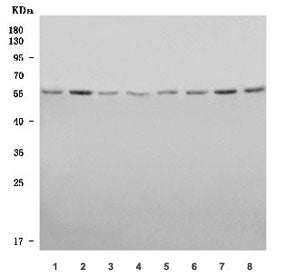 Western blot testing of human 1) HeLa, 2) 293T, 3) PANC-1, 4) Jurkat, 5) MOLT4, 6) Caco-2, 7) SH-SY5