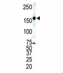 ERBB4 Antibody (HER4)