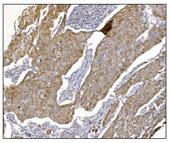 NDEL1 Antibody / Nudel
