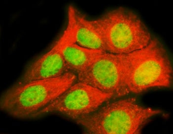 TRPS1 Antibody / Tricho-rhino-phalangeal syndrome type I