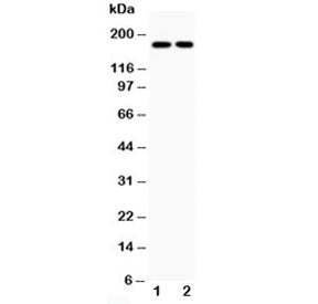 Topoisomerase II alpha Antibody