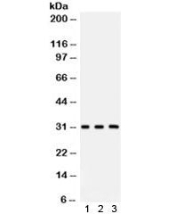 Western blot testing of 1) rat brain, 2) mouse brain and 3) human HeLa lysate with Peroxiredoxin 4 a
