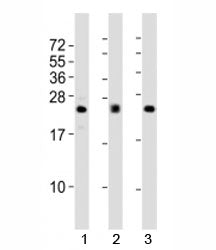 Western blot testing of FGF2 antibody at 1:2000 dilution; Lane 1: human A549 lysate, 2: mouse heart