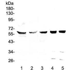 TCP1 eta Antibody / CCT7