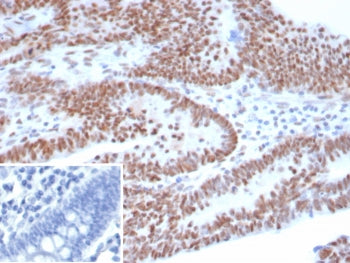 p53 Antibody / TP53