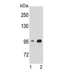 Beta Catenin Antibody