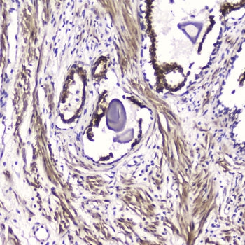 ATF4 Antibody
