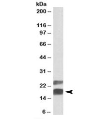 CIRBP Antibody