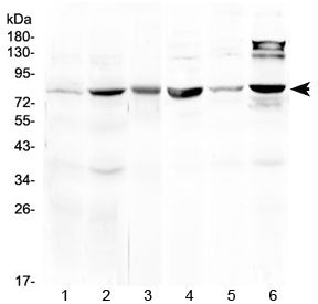 17-beta-Hydroxysteroid dehydrogenase 4 Antibody (HSD17B4)
