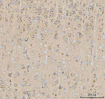 NPTXR Antibody / Neuronal pentraxin receptor