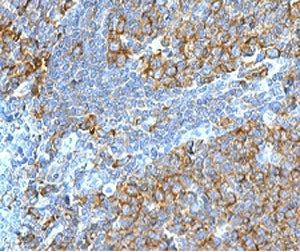 IHC testing of FFPE human tonsil stained with RPSA antibody (clone LMNR-1). Required HIER: boiling t