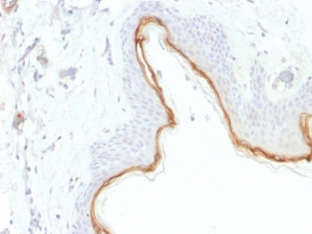 IHC testing of FFPE human skin with Filaggrin antibody (clone FLG/1945). Required HIER: boil tissue