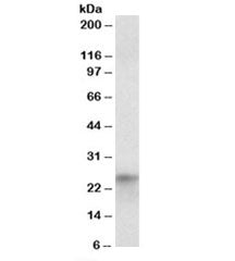Western blot testing of HepG2 nuclear lysate with HES4 antibody at 1ug/ml. Predicted molecular weigh