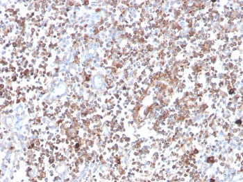 IHC staining of FFPE human tonsil with PRKCA antibody (clone 133). HIER: boil tissue sections in pH