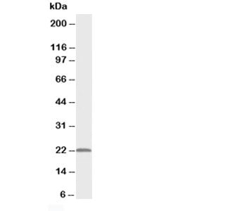 PMVK Antibody