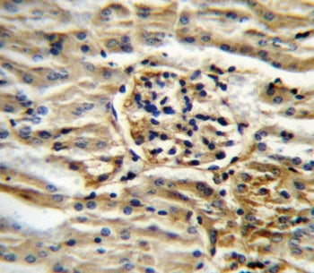 CYP11B2 Antibody