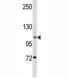 DOG1 Antibody (TMEM16A, ANO1)