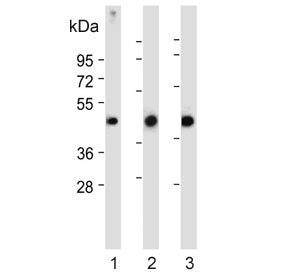 P2RY5 Antibody / P2Y Purinoceptor 5 / LPAR6