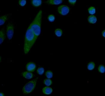 Serum Amyloid P Antibody