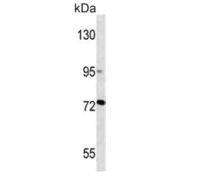 MMP2 Antibody