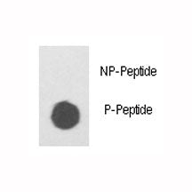 Phospho-ILK Antibody (pS343)