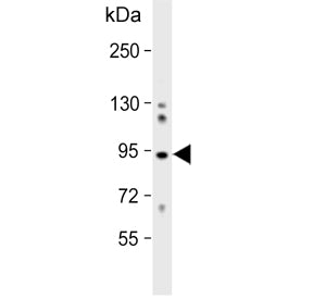 Western blot testing of human K562 cell lysate with COG4 antibody. Predicted molecular weight ~89 kD