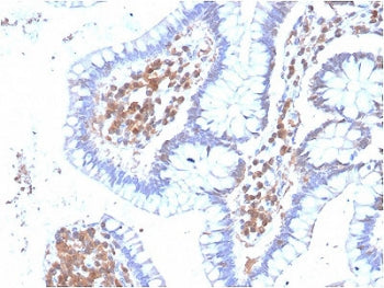 p38 MAPK Antibody / MAPK14