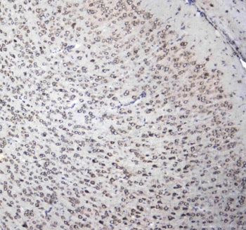 L1CAM Antibody / NCAM-L1 / CD171
